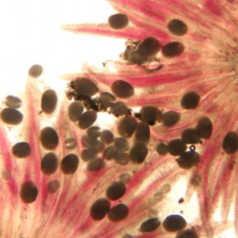 Larval molluscs (glochidia) on gills of salmon.