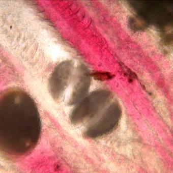 Larval molluscs (glochidia) on gills of salmon.