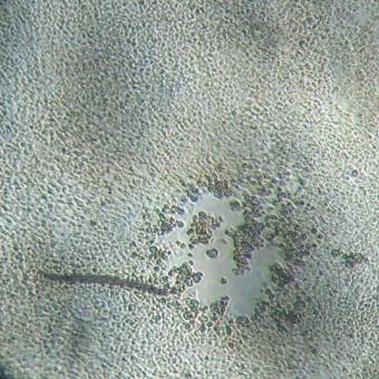 Light micrograph of plaque caused by IHN virus.