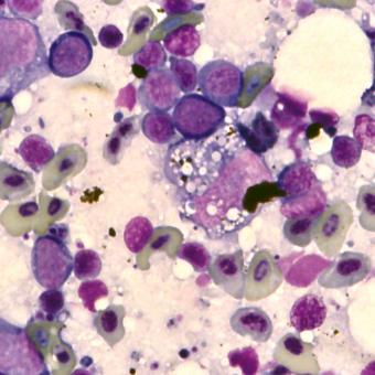 Stained blood smear showing characteristic EIBS inclusion bodies.