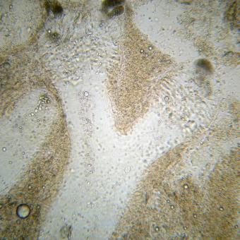 Ichthyophonus growing in dead host tissue.