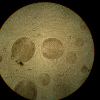 Mollusc glochidia on gills of steelhead trout.