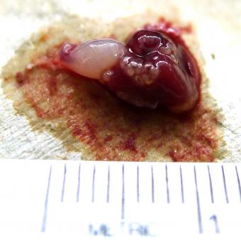 Bluegill heart with white trematode metacercariae.