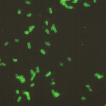 Fluorescence microscopy image of renibacterium cells.