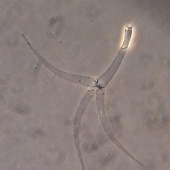 Myxobolus cerebralis actinospore with fired polar filaments.