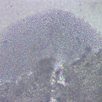 Ruptured microsporidian cyst showing individual spores.