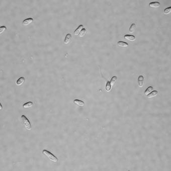 Microsporidian spores.