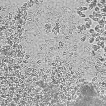 Microsporidian spores.