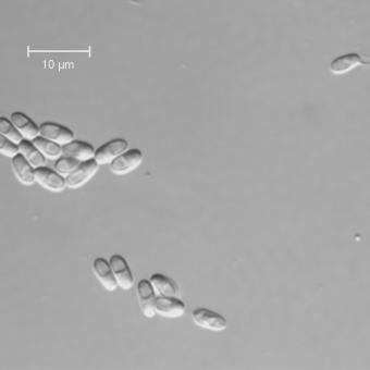 Microsporidian spores.