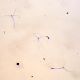 Triactinomyxon spores of M. cerebralis.