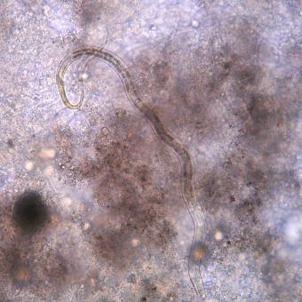 Free-living nematode worm.