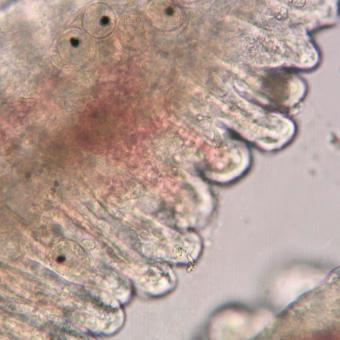 Sanguinicola blood flukes in blood vessels of gills.