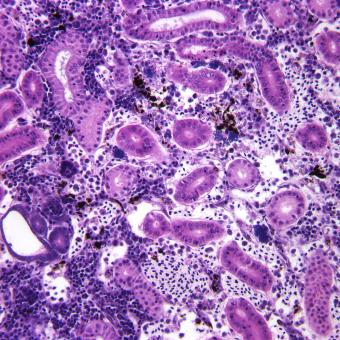 Aeromonas damage to kidney tissue.