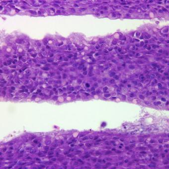 Flavobacterium (thin filaments) adhering to gill epithelium.