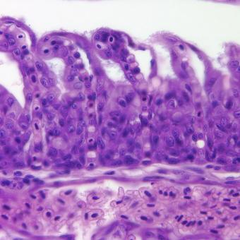 Flavobacterium (thin filaments) adhering to gill epithelium.