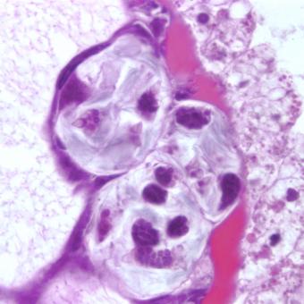 Pansporocysts of M. cerebralis actinospores developing in gut wall of worm host.