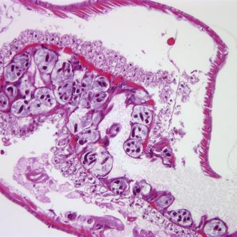 Pansporocysts of M. cerebralis actinospores developing in gut wall of worm host.