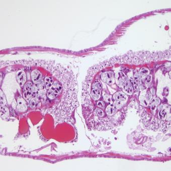 Pansporocysts of M. cerebralis actinospores developing in gut wall of worm host.