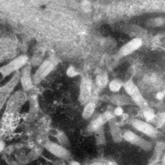 Electron micrograph of VHSV particles