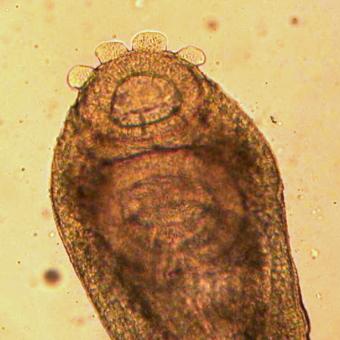 Adult Crepidostomum fluke showing anterior sucker.