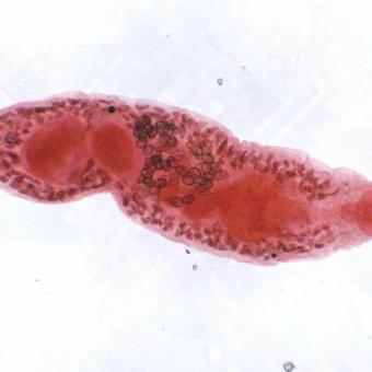 Adult Crepidostomum fluke.