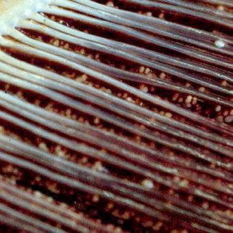 Dermocystidium in gills of Fall Chinook.