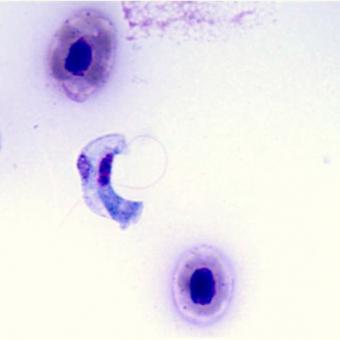 Stained blood smear showing the hemoflagellate Cryptobia salmositica.