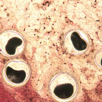 Nanophyetus metacercaria in fresh tissue squash.