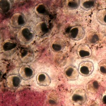 Nanophyetus metacercaria in fresh tissue squash.