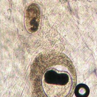 Metacercaria of Nanophyetus and an unknown trematode in fresh tissue squash.