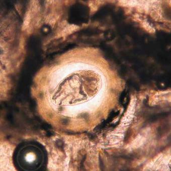 Neascus metacercarium glowing brightly where it lets light through a thick tissue squash.