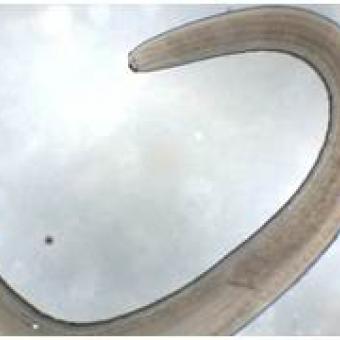 Anisakis simplex nematode.