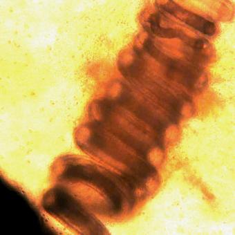 Coiled nematode worm.