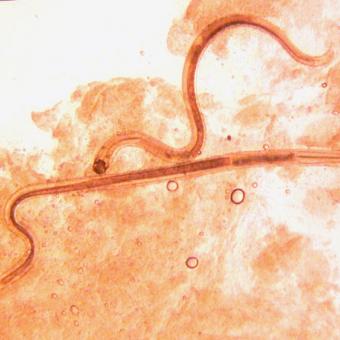 Adult Camallanus nematodes.