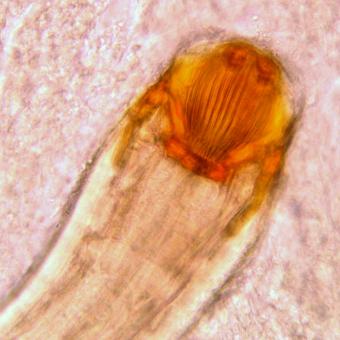 Distinctive mouthparts of Camallanus nematode.