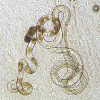 Adult Capillaria nematode.