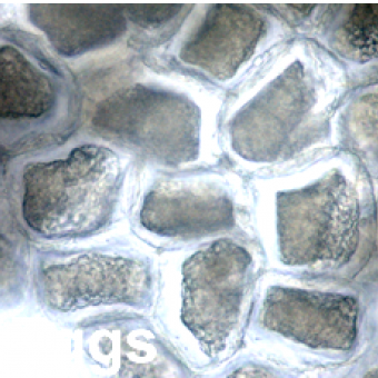 Hysterothylacium sp. nematode eggs.