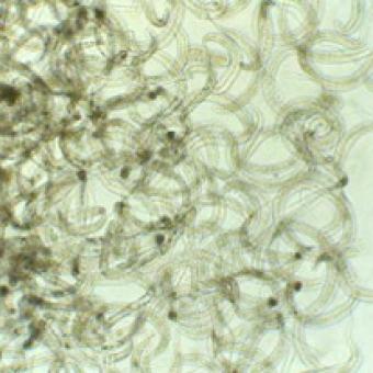 A mass of adult Philonema nematodes.