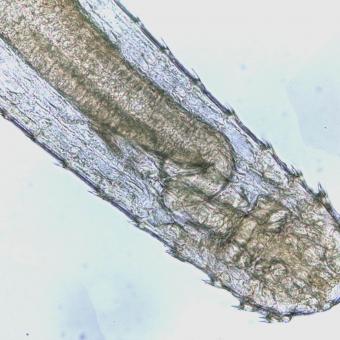 Anterior (head) end of adult Spinitectus nematode.