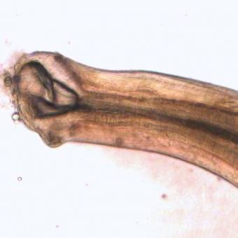 Mouthparts of a Truttaedacnitis nematode.