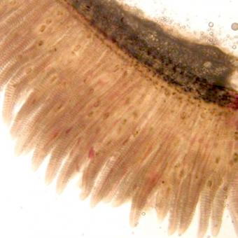 Trematode metacercariae within gill filaments.