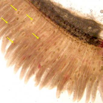 Trematode metacercariae (arrowed) in gills.