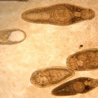 Several species of adult trematodes from intestine.