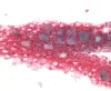 Ichthyobodo in Chinook gill section.
