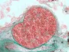 Loma cyst in gill filament.