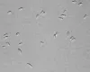 Microsporidian spores.