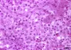 High magnification view of necrosis caused by E. ictaluri